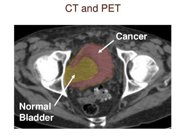 Ct scan iv trading system