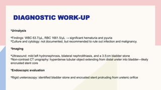 Bladder Stone & Encrusted DJ Stent.pptx Bladder Stone & Encrusted DJ ...