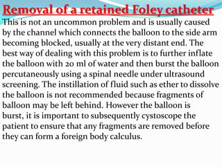 Removal of a retained Foley catheter
This is not an uncommon problem and is usually caused
by the channel which connects the balloon to the side arm
becoming blocked, usually at the very distant end. The
best way of dealing with this problem is to further inflate
the balloon with 20 ml of water and then burst the balloon
percutaneously using a spinal needle under ultrasound
screening. The instillation of fluid such as ether to dissolve
the balloon is not recommended because fragments of
balloon may be left behind. However the balloon is
burst, it is important to subsequently cystoscope the
patient to ensure that any fragments are removed before
they can form a foreign body calculus.
 