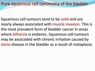 Pure squamous cell carcinoma of the bladder


Squamous cell tumours tend to be solid and are
nearly always associated with muscle invasion. This is
the most prevalent form of bladder cancer in areas
where bilharzia is endemic. Squamous cell tumours
may be associated with chronic irritation caused by
stone disease in the bladder as a result of metaplasia.
 