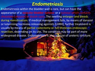 Endometriosis
Endometriosis within the bladder wall is rare, but can have the
appearance of a vascular bladder tumour or a tumour which contains
chocolate-coloured or bluish cysts. The swelling enlarges and bleeds
during menstruation. If medical management fails, by means of danazol
or luteinising hormone-releasing agonists (LHRH), further treatment is
usually by means of partial cystectomy or full-thickness endoscopic
resection, depending on its site. The condition may be part of more
widespread disease. Endometriosis is also a cause of ureteric stricture.
 