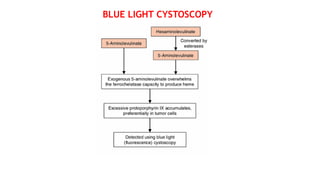 BLUE LIGHT CYSTOSCOPY
 