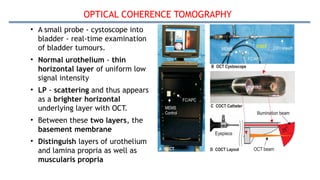 OPTICAL COHERENCE TOMOGRAPHY
• A small probe - cystoscope into
bladder - real-time examination
of bladder tumours.
• Normal urothelium - thin
horizontal layer of uniform low
signal intensity
• LP - scattering and thus appears
as a brighter horizontal
underlying layer with OCT.
• Between these two layers, the
basement membrane
• Distinguish layers of urothelium
and lamina propria as well as
muscularis propria
 