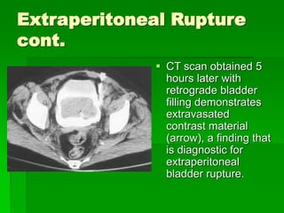 bladtr [EDocFind.com].ppt