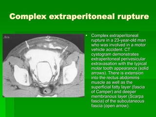bladtr [EDocFind.com].ppt