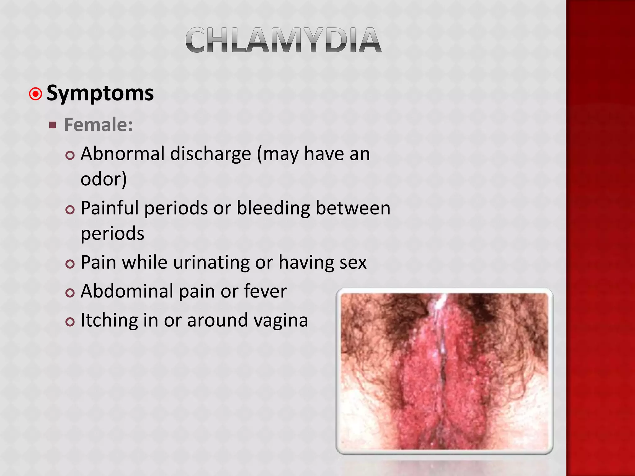 STDsSexually Transmitted DiseasesAlso known as STIs: sexually transmitted infectionsSTDs are infectious diseases usually transmitted from person to person through sexual intercourse or other intimate contactIf untreated, they can cause permanent damage such as infertility and can lead to life-threatening conditionsSTD transmission can be prevented by the use of condoms or the practice of abstinence.