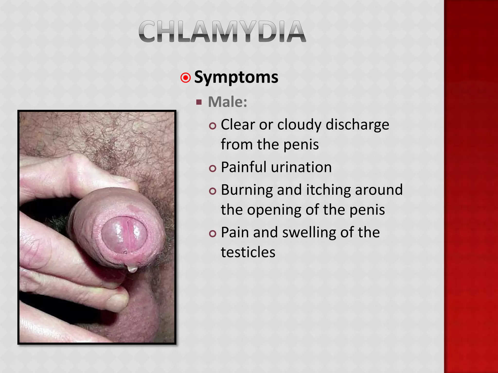 There are 65 million people living in the US with an incurable STD. That is 1 in 4 people!In the US there are over 19 million new STD infections every year, and almost half of them are among young people ages 15-24 years old