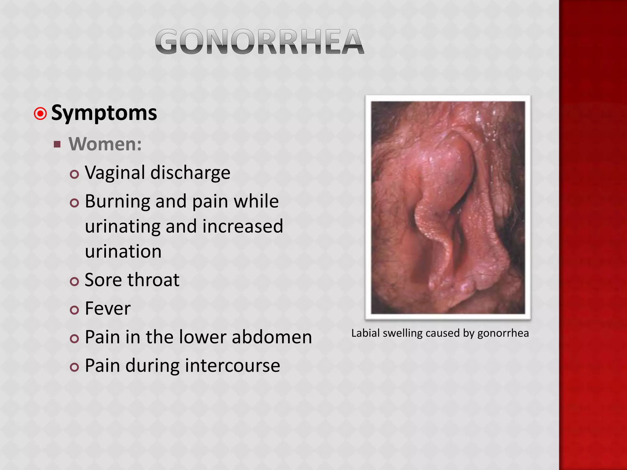 Common STDsChlamydiaGonorrheaGenital HerpesSyphilisHIV/AIDSHepatitis