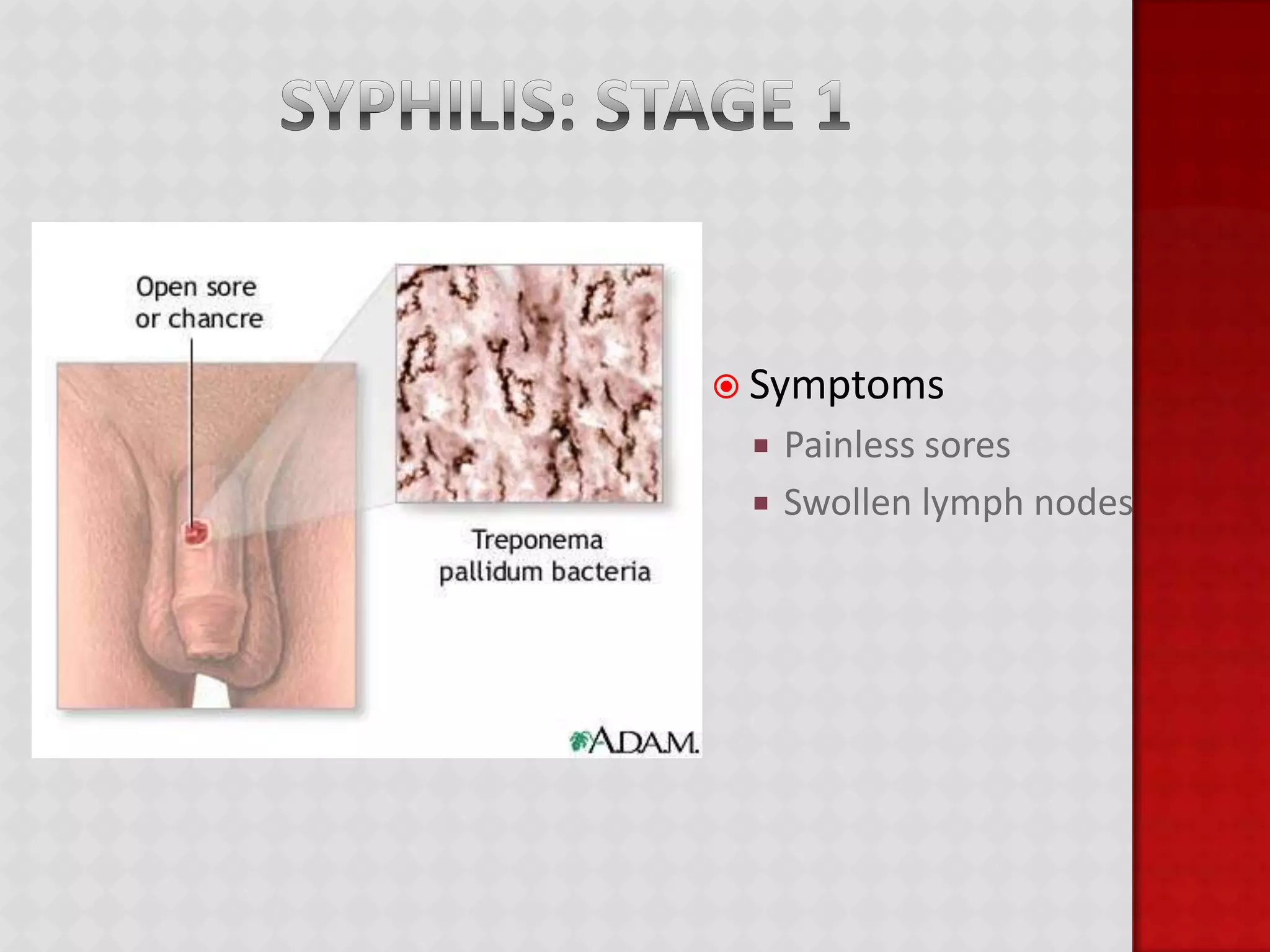 Hepatitis BA virus that primarily infects the liver causing inflammationResults from exposure to blood or bodily fluids containing blood, including unprotected sexual contact and contaminated needles.Can be prevented by a vaccineCan be treated with antiviral treatment