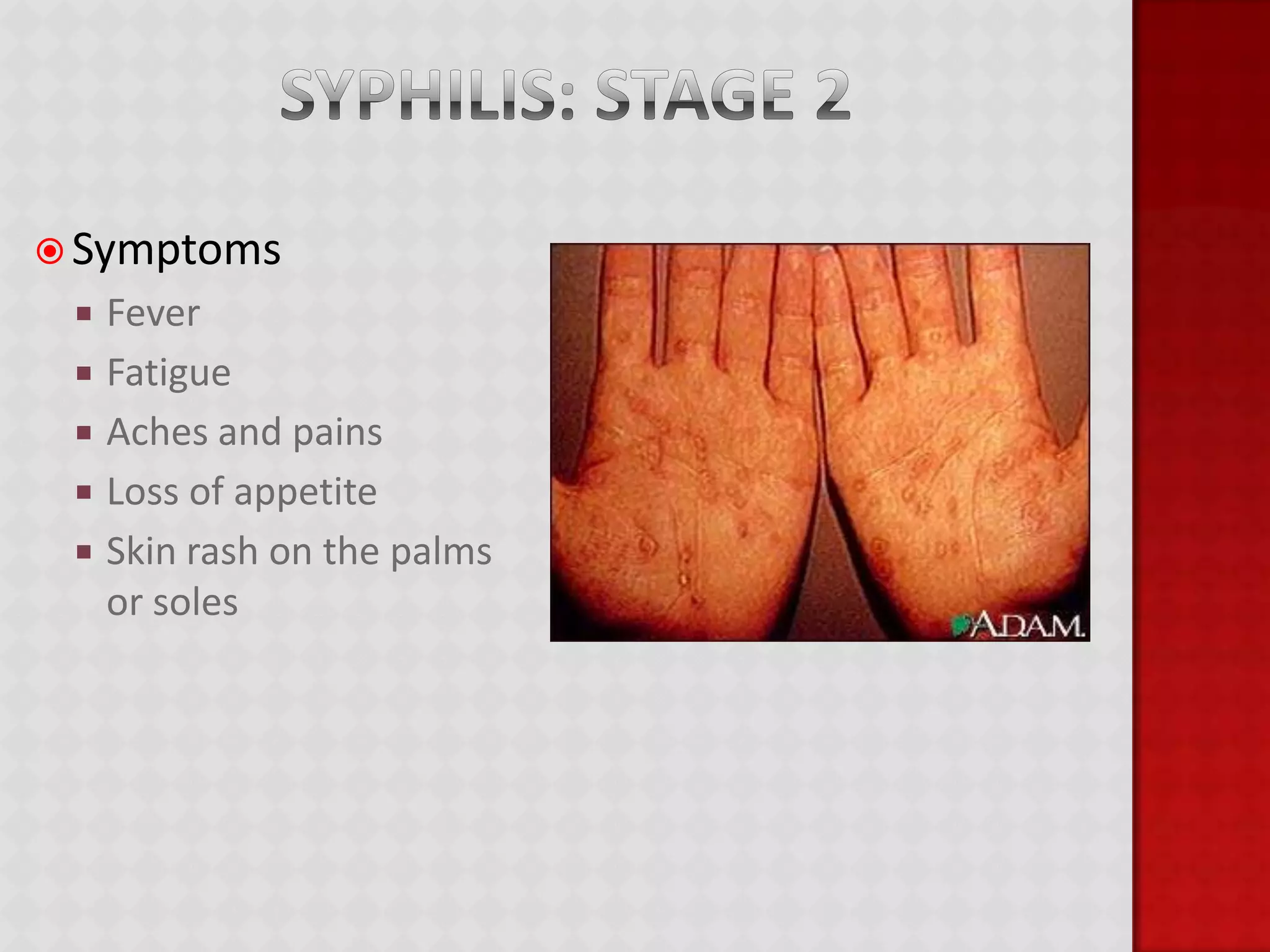 Hepatitis B	Symptoms	Abdominal PainDark UrineJoint PainLoss of appetiteWeakness and fatigueNausea and vomitingYellowing of the skin