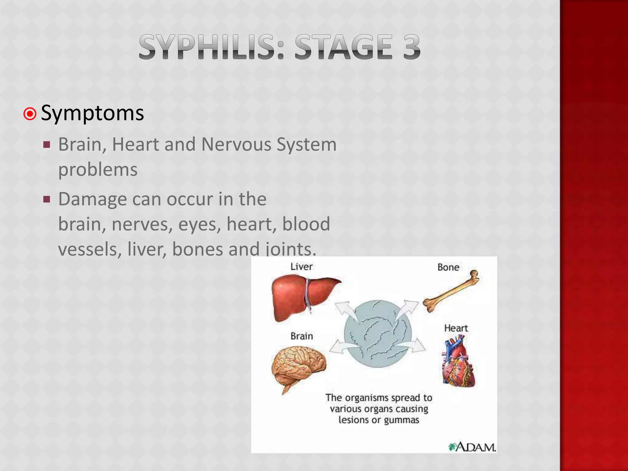 HPVHPV stands for Human PapillomavirusThere is no cure for HPVThere are over 100 types of HPV, some which can cause complications such as cervical cancer. Can be prevented by a vaccine.