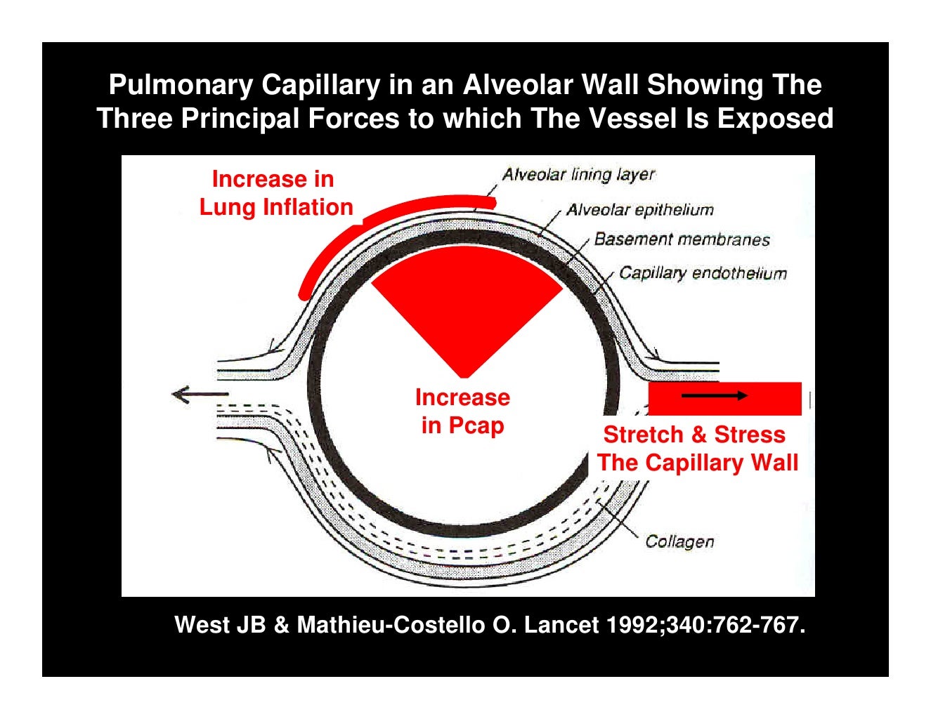 Ventilator Induced Lung Injury