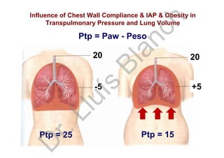 20
+5
20
-5
Influence of Chest Wall Compliance & IAP & Obesity in
Transpulmonary Pressure and Lung Volume
Ptp = 25 Ptp = 15
Ptp = Paw - Peso
D
r.Lluís
Blanch
 
