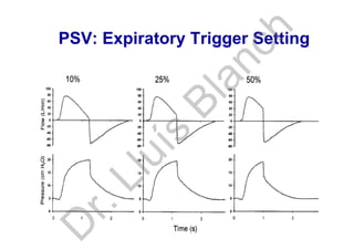 PSV: Expiratory Trigger Setting
D
r.Lluís
Blanch
 
