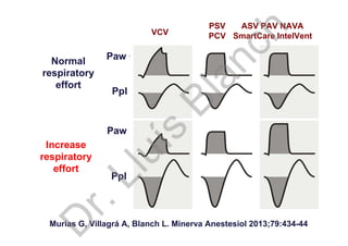 Murias G, Villagrá A, Blanch L. Minerva Anestesiol 2013;79:434-44
Ppl
Ppl
Paw
Paw
Increase
respiratory
effort
ASV PAV NAVA
SmartCare IntelVentVCV
PSV
PCV
Normal
respiratory
effort
D
r.Lluís
Blanch
 
