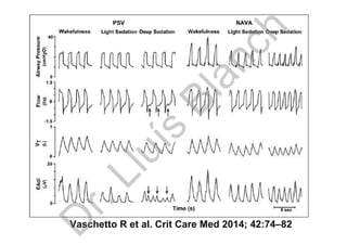 Vaschetto R et al. Crit Care Med 2014; 42:74–82
D
r.Lluís
Blanch
 