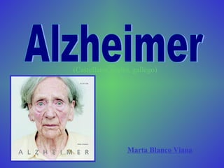Alzheimer Marta Blanco Viana (Castellano, inglés, gallego) 