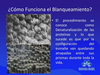 ¿Cómo Funciona el Blanqueamiento?
• El procedimiento se
conoce como
Denaturalización de las
proteínas y lo que
sucede es que por la
configuración del
esmalte van quedando
atrapadas entre sus
prismas durante toda la
vida.
 