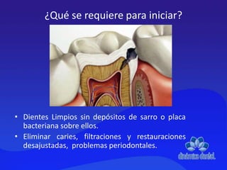 ¿Qué se requiere para iniciar?
• Dientes Limpios sin depósitos de sarro o placa
bacteriana sobre ellos.
• Eliminar caries, filtraciones y restauraciones
desajustadas, problemas periodontales.
 