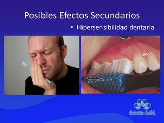 Posibles Efectos Secundarios
• Hipersensibilidad dentaria
 