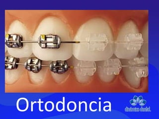 Ortodoncia
 