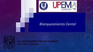 Blanqueamiento Dental
C.D. JOSÉ EDUARDO PANTOJA GONZÁLEZ
CED. PROF. 11521343
 