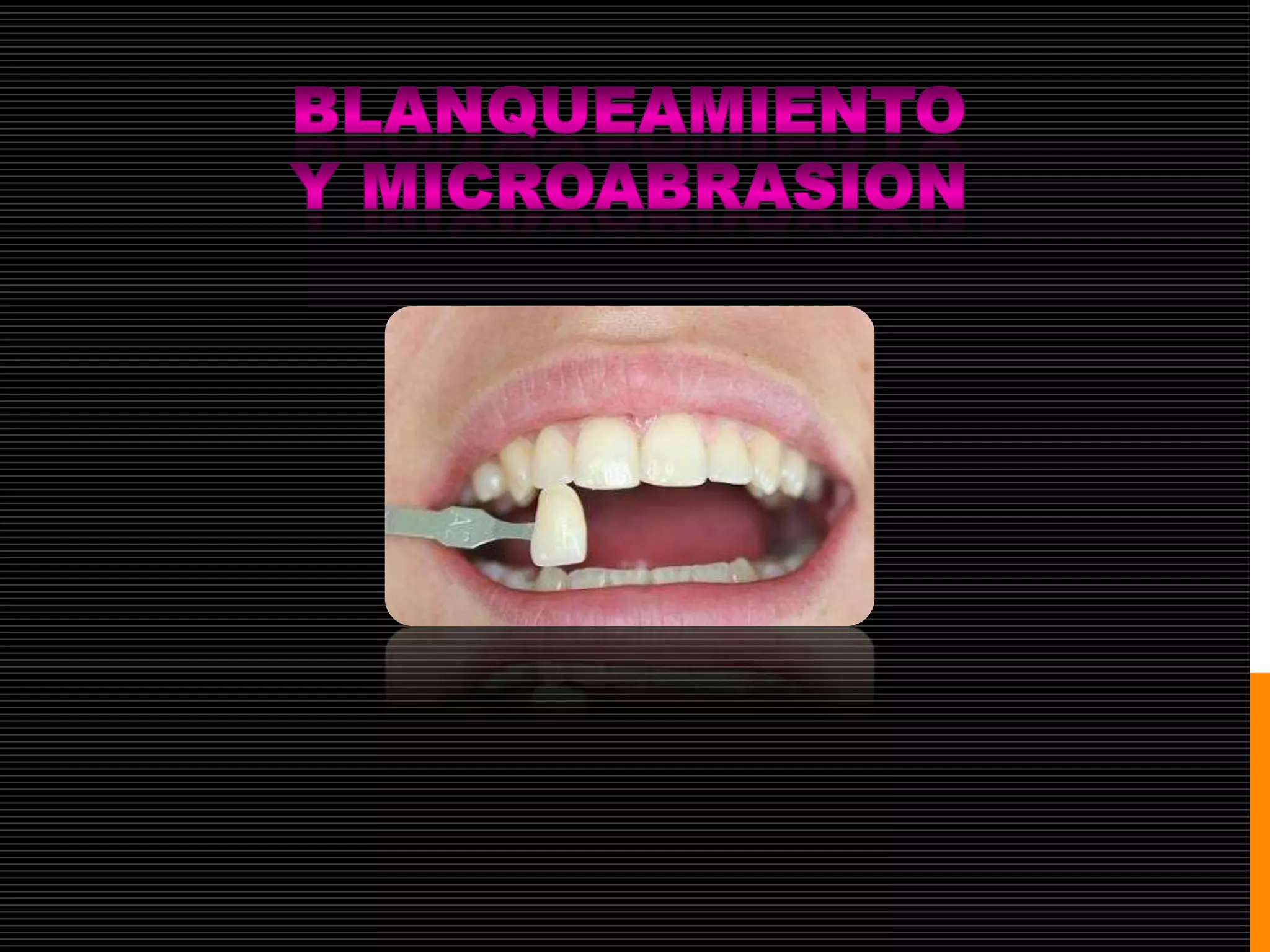 Blanqueamiento y microabrasion dental PPT