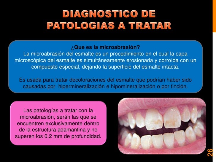 Blanqueamiento y microabrasion dental