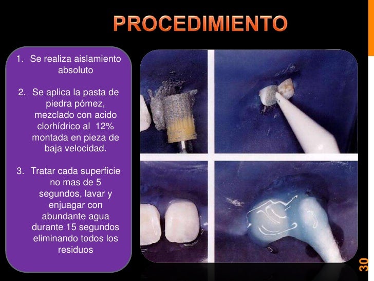 Blanqueamiento y microabrasion dental