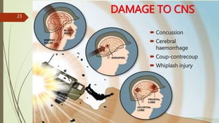 DAMAGE TO CNS
 Concussion
 Cerebral
haemorrhage
 Coup-contrecoup
 Whiplash injury
23
 
