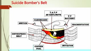 Suicide Bomber’s Belt
7
 