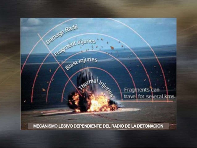 Lesiones Por Explosión Blast