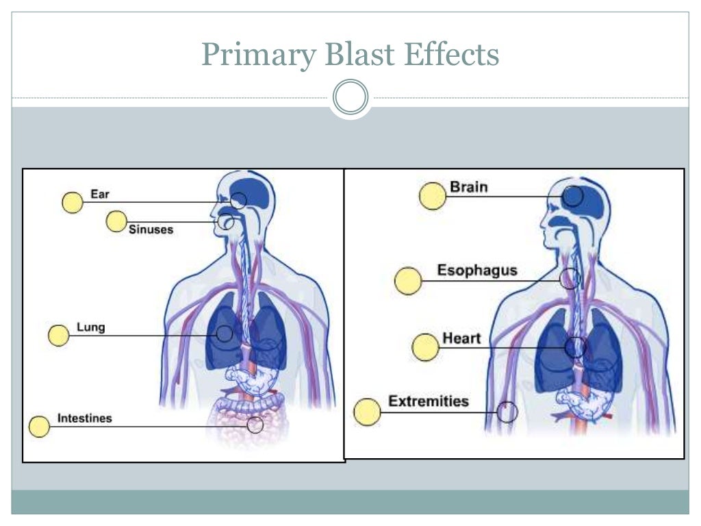 Blast injuries