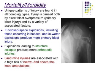 Mortality/Morbidity
 Unique patterns of injury are found in
all bombing types. Injury is caused both
by direct blast overpressure (primary
blast injury) and by a variety of
associated factors.
 Enclosed-space explosions, including
those occurring in busses, and in-water
explosions produce more primary blast
injury.
 Explosions leading to structure
collapse produce more orthopedic
injuries.
 Land mine injuries are associated with
a high risk of below- and above-the-
knee amputations.
 