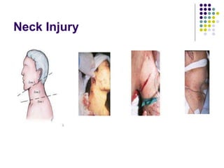 Neck Injury
 