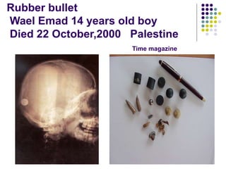 Rubber bullet
Wael Emad 14 years old boy
Died 22 October,2000 Palestine
Time magazine
 