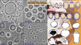Blastocistosis (Blastocystis hominis)