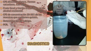 Blastocistosis (Blastocystis hominis)