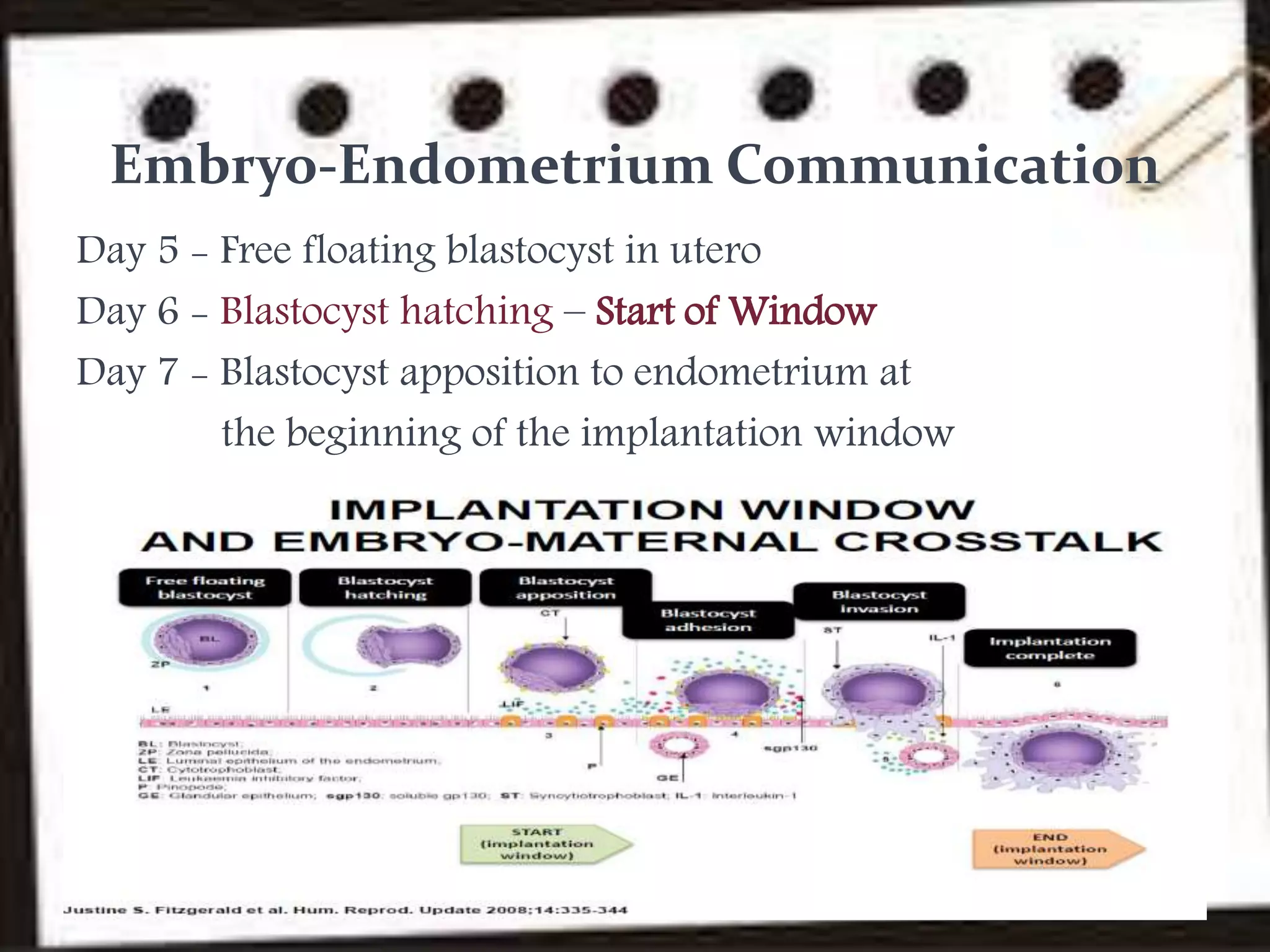 Blastocyst transfer PPT
