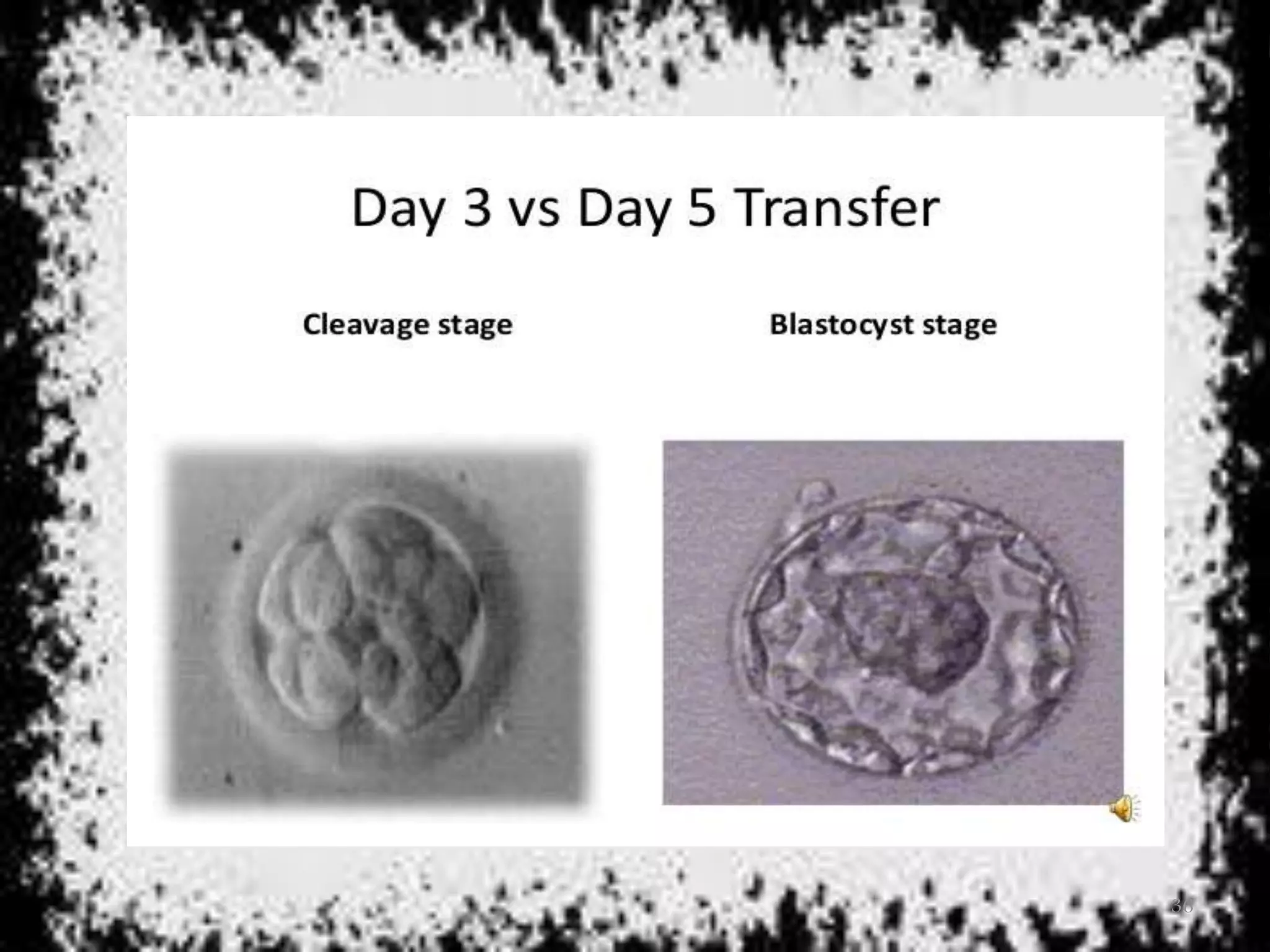 Blastocyst transfer PPT