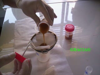 Blastocystis hominis GRACIAS! 