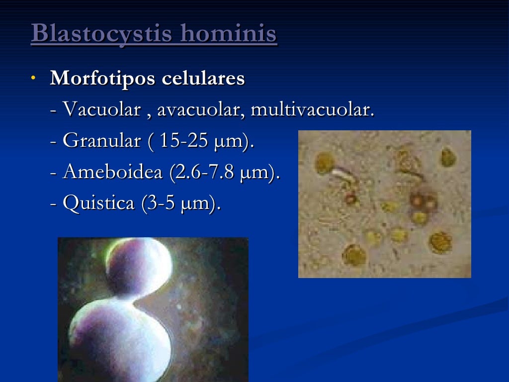 Blastocystis Hominis