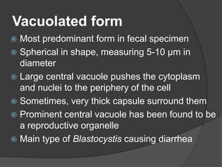 Vacuolated form
 Most predominant form in fecal specimen
 Spherical in shape, measuring 5-10 µm in
  diameter
 Large central vacuole pushes the cytoplasm
  and nuclei to the periphery of the cell
 Sometimes, very thick capsule surround them
 Prominent central vacuole has been found to be
  a reproductive organelle
 Main type of Blastocystis causing diarrhea
 