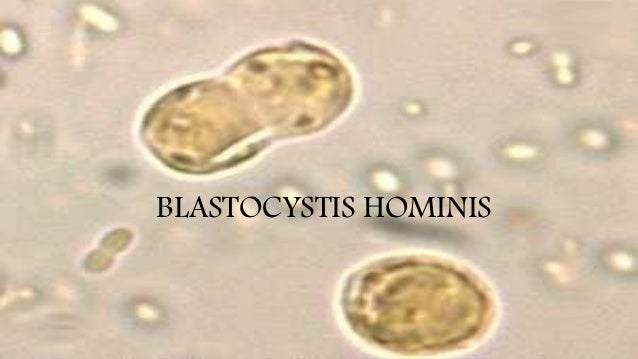 Blastocystis hominis