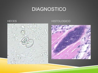 DIAGNOSTICO
HECES HISTOLOGICO
 