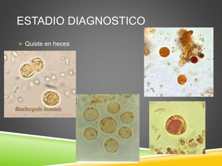 ESTADIO DIAGNOSTICO
Quiste en heces