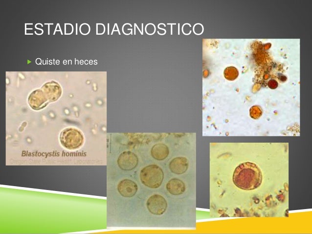 Blastocystis y sarcocystis