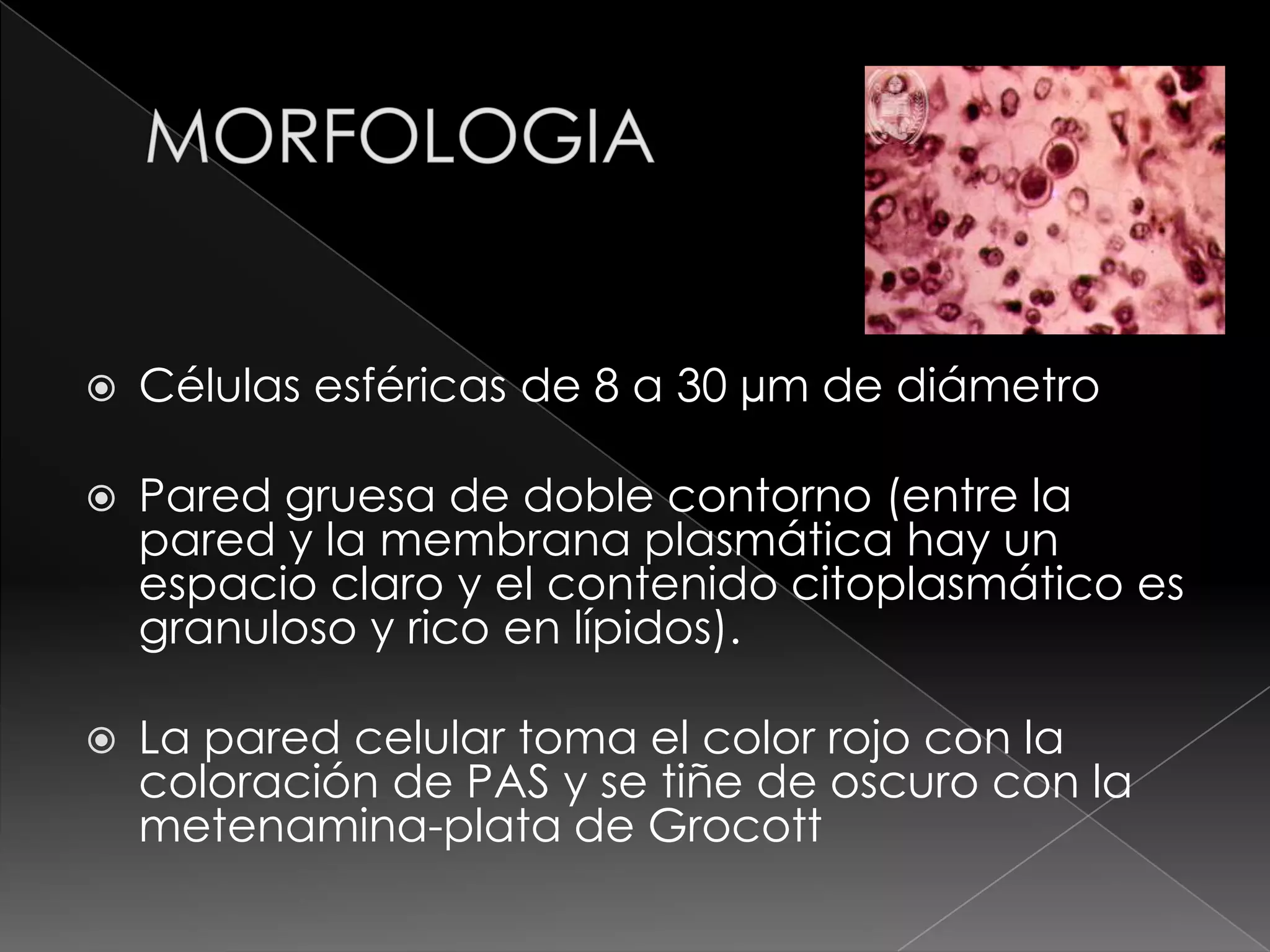 Blastomicosis PPT