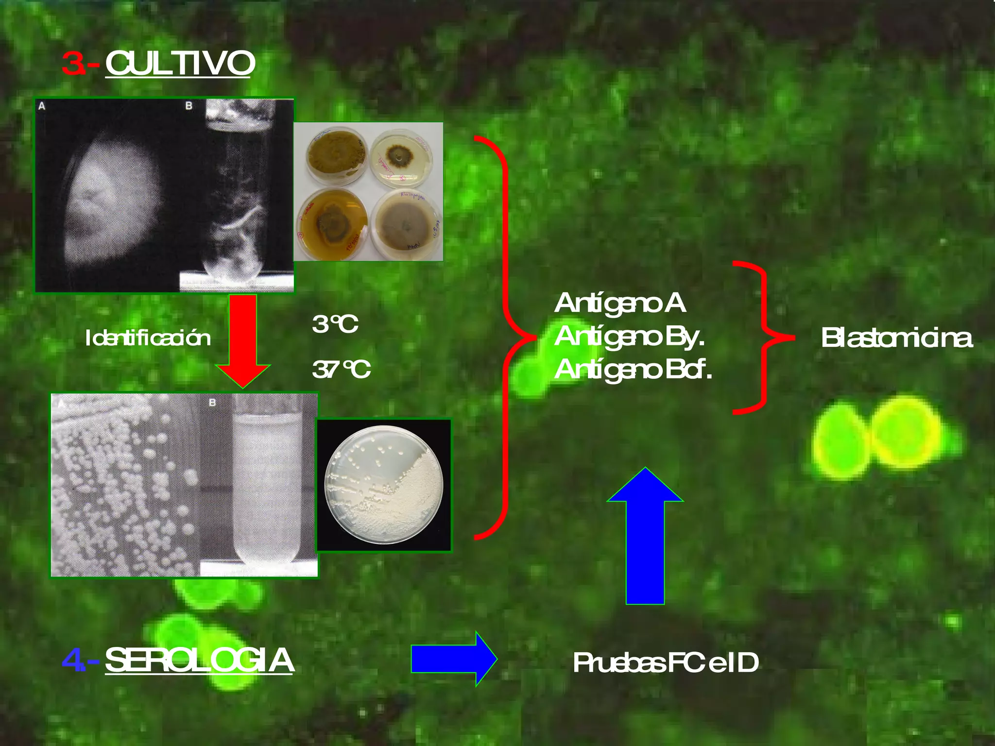 3.- CULTIVO 4.- SEROLOGIA Antígeno A Antígeno By. Antígeno Bcf. Pruebas FC e ID Blastomicina 3 ºC 37 ºC Identificación