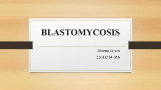BLASTOMYCOSIS
Aleena akram
22011514-056
 
